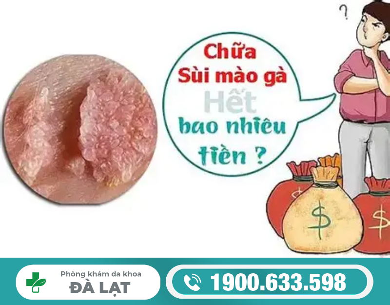 Hình ảnh minh họa